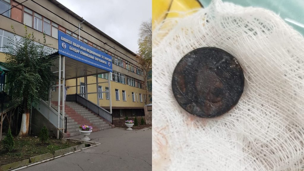 В Бишкеке врачи извлекли монету из пищевода двухлетнего ребенка — Новости Кыргызстана