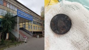 Бишкекте дарыгерлер 2 жаштагы баланын кызыл өңгөчүнөн тыйынды алып чыгышты — Новости Кыргызстана